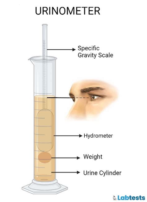 Urine Specific Gravity Test Principle Normal Values Method