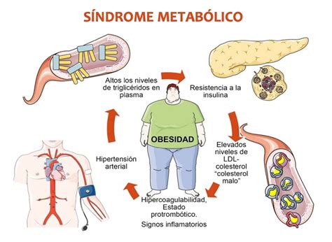 Síndrome Metabólico Y Testosterona ¿qué Relación Existe Mens App