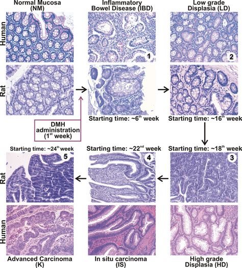 Histology Of Colonic Mucosa In Rat Model Of Dmh Induced Colorectal