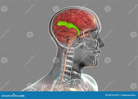 Human Brain In Body With Highlighted Superior Temporal Gyrus Stock