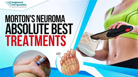 Mortons Neuroma Absolute Best Treatments Youtube