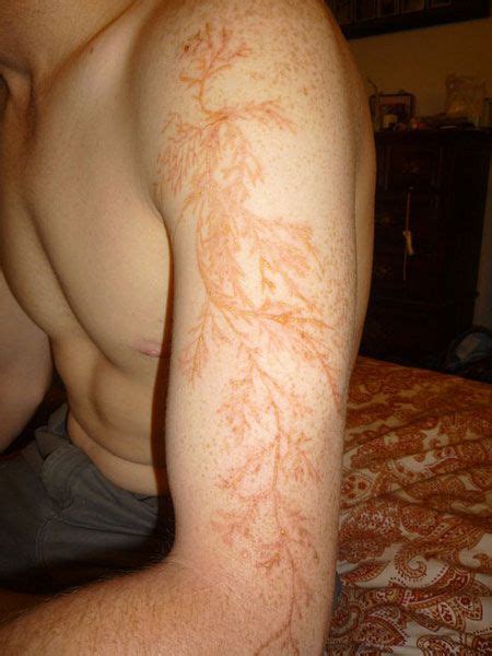 A Fascinating Look At A Permanent Scar Left By Lightning Geeky Things Lightning Tattoo