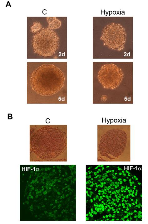 Hypoxia Influences Growth And Hif 1α Activation In Cancer Stem Cells Download Scientific