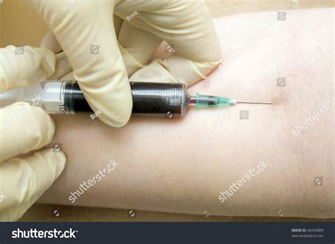 Intravenous Injection Stock Photo 42434809 : Shutterstock