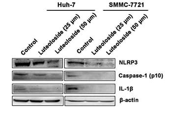 Macrophage Nlrp Inflammasome Activation Drives Disease