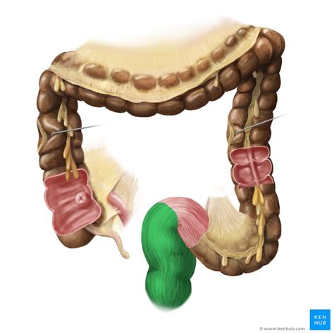 Illustration Of A Cross Section Of The Lower Rectum Showing The My XXX Hot Girl