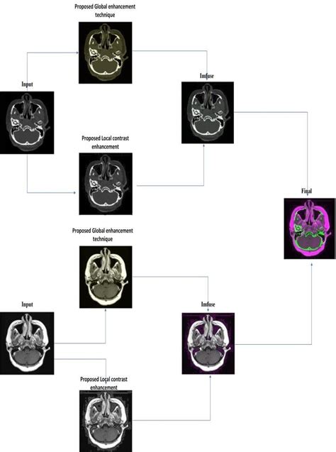 Example 1 Input Images Are The Computed Tomography Ct Top Left And Download Scientific