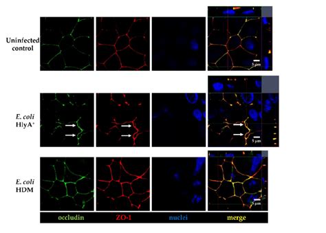 Subcellular Tight Junction Distribution In HlyA E Coli Infected