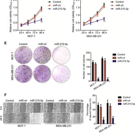 MiR2155p Suppresses Growth Migration And Invasion Of Breast Cancer