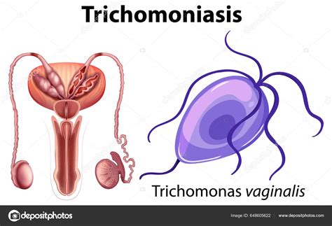 Trichomonas Vaginalis White Background Illustration Stock Vector By