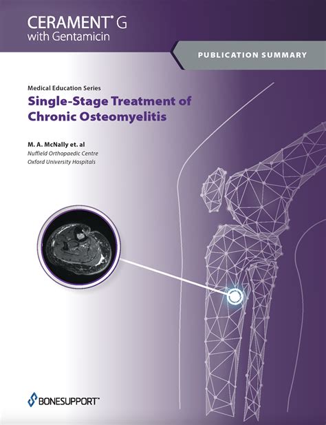 Single-Stage Treatment of Chronic Osteomyelitis - BONESUPPORT