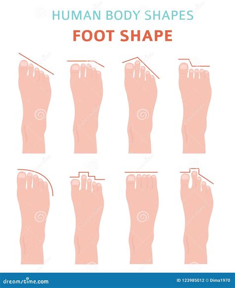 Human Body Shapes Feet Types Icon Set Stock Vector Illustration Of