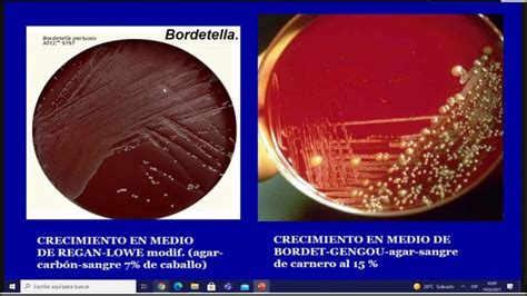 🧫 Microbiología Practica Bacterias Gram Negativas Iii Youtube