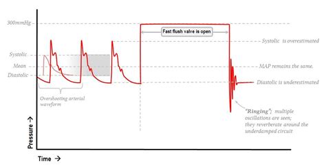 Art Line Waveform Explanation Lorretta Ivy