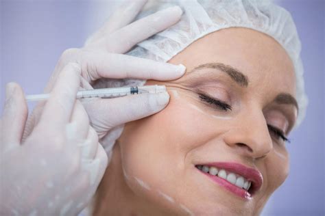 Quanto Tempo Dura O Botox Saiba Tudo Sobre O Procedimento