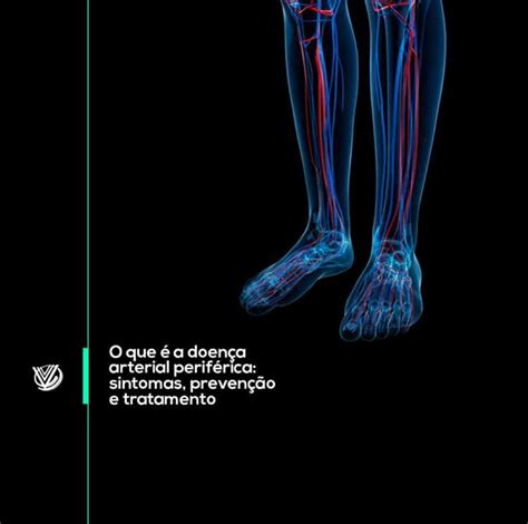 O que é a doença arterial periférica sintomas prevenção e tratamento