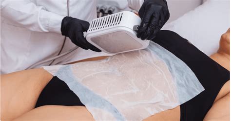 Discover The Benefits Of Fat Freezing Treatment