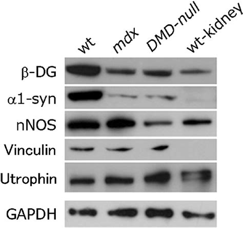 Western Blot Analysis Immunoblots For Dystrophin Related Proteins In