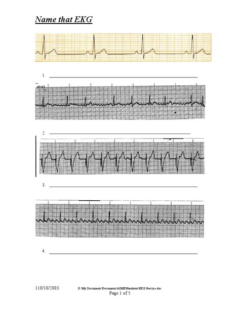 Ekg Practice Worksheets Pdf