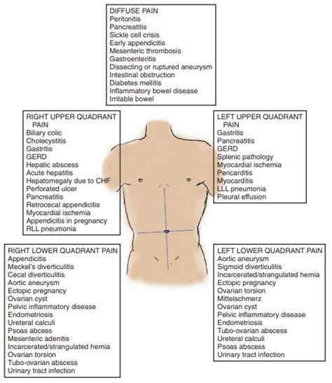 Dolor Abdominal Mapa Mental