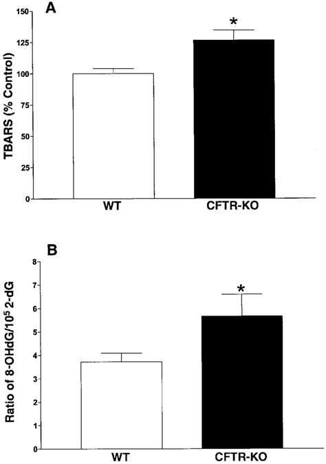 Concentration Of Thiobarbituric Acid Reactive Substances Tbars A And