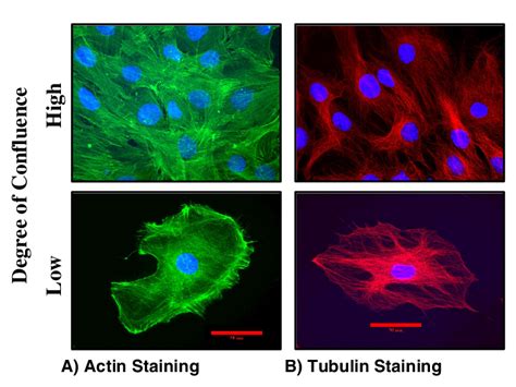 Cytoskeletal Staining Of A Actin Filaments And B Tubulin Filaments