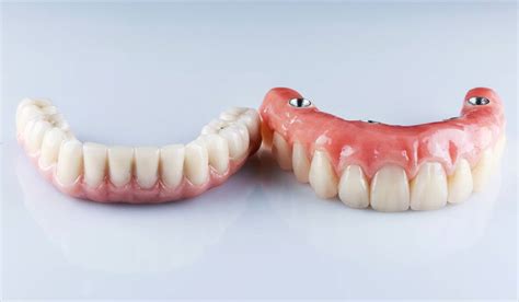 Pros And Cons Of Permanent Dentures Dmc