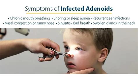 Adenoidectomy Procedure Benefits And Recovery Apollo Spectra Hospitals