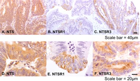 Figure 1 From Characterisation Of The Expression Of Neurotensin And Its