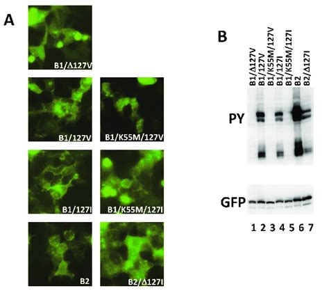 Localization And Tyrosine Phosphorylation Of Wild Type And Mutant