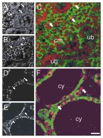 Localization of P2X7 immunostaining and pyknotic nuclei by confocal ...