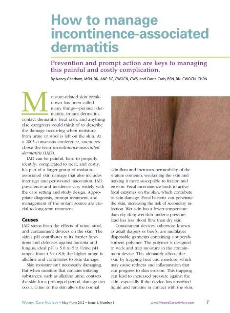 How To Manage Incontinence Associated Dermatitis Prevention And