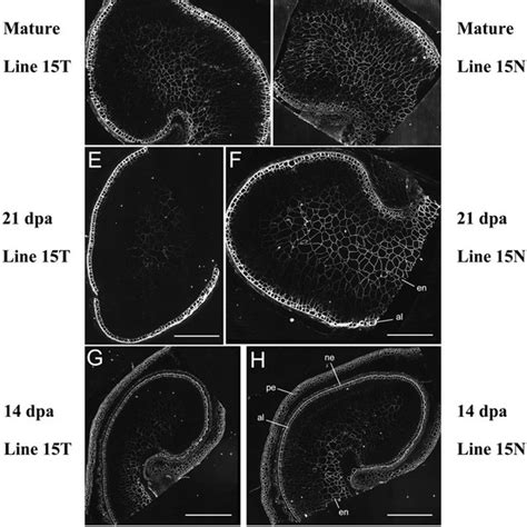 Immunolabeling Of B Glucan In Mature Grain Ad And Developing