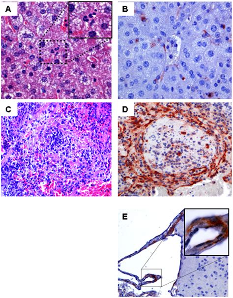 Histopathology Of Several Tissues Staining Positive For Chikv