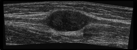 Musculoskeletal, bone, muscle, nerves and other soft tissues | 7.3 ...