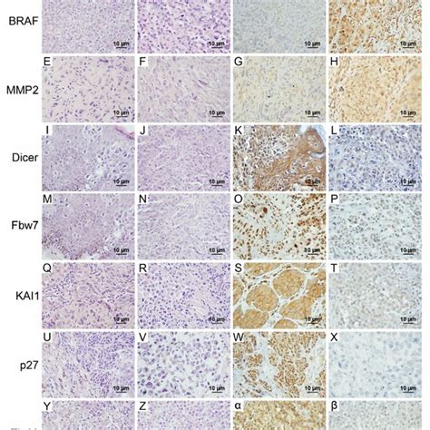 Representative H E And Immunohistochemical Staining Of 7 Candidate