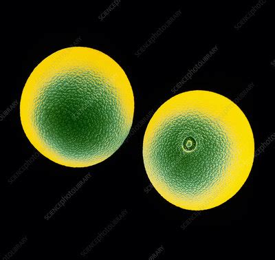 False Col Sem Of Two Pollen Grains Stock Image B Science