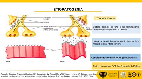 Expo De Tetano 2 Pptx Descarga Gratuita