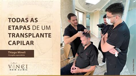 Confira Todas As Etapas De Um Transplante Capilar Youtube