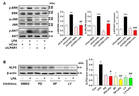 Lpainduced Klf Expression Is Regulated By The Mapk And Akt Signaling