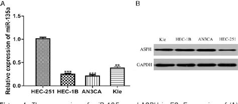 Figure 1 From MiR 135a Acts As A Tumor Suppressor By Targeting ASPH In