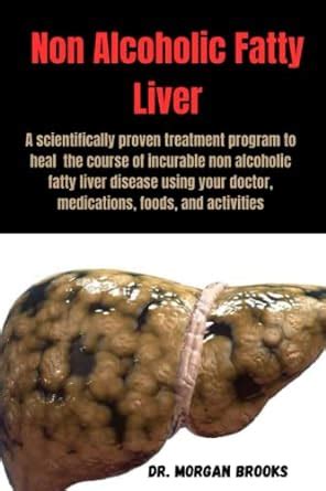 Non Alcoholic Fatty Liver Disease A Scientifically Proven Treatment