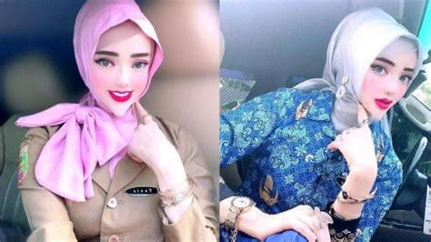 Wajah Asli PNS Viral Bermuka Barbie Dibongkar Dokter Richard Lee Dagu