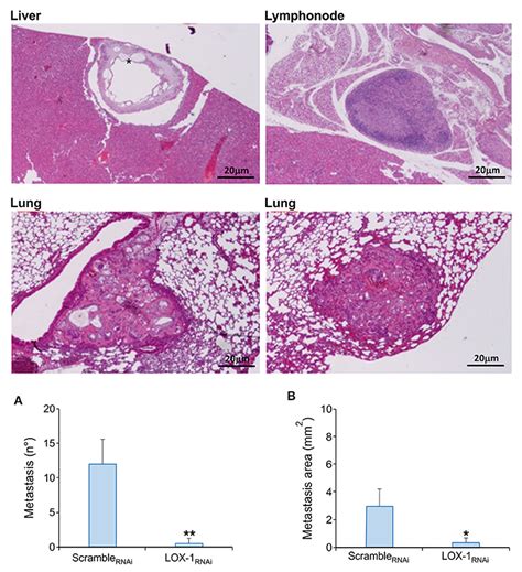 Frontiers Targeting Lox Inhibits Colorectal Cancer Metastasis In An