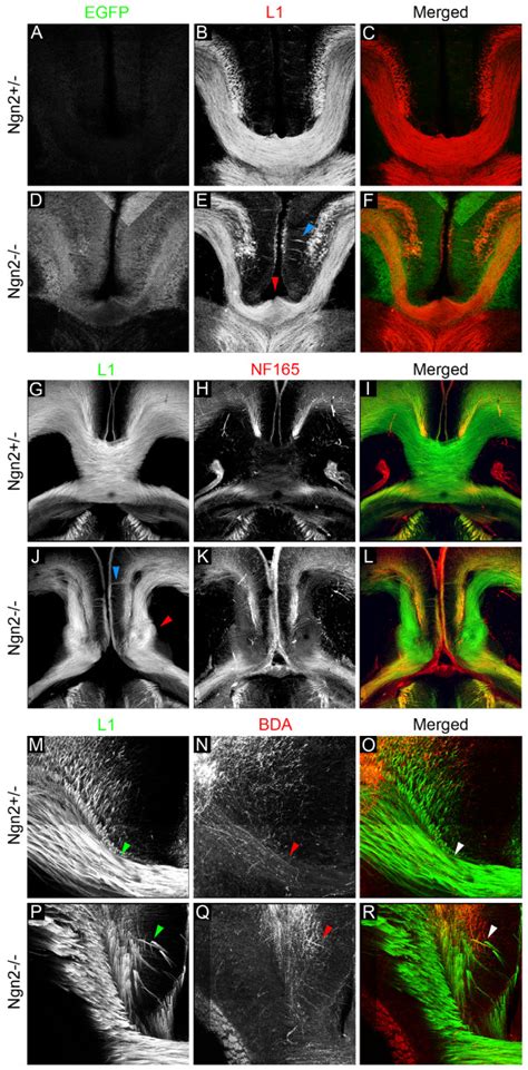 Ngn2 Regulates Callosal Axon Projection And Corpus Callosum Formation