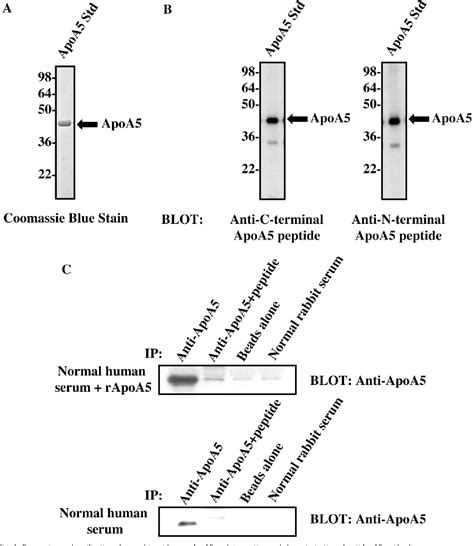 Figure From The Novel Apolipoprotein A Is Present In Human Serum Is