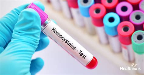 Homocysteine Test Need Results And Process Healthians Blog