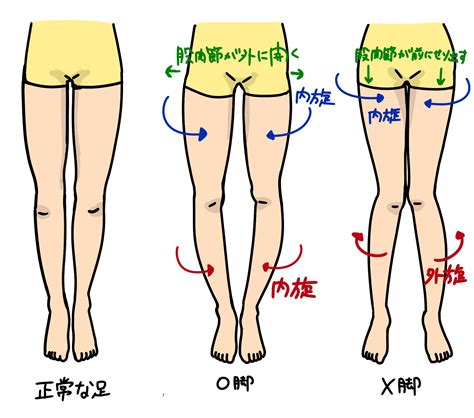 【o脚x脚】原因や改善方法とは？｜ 記事一覧 ｜ストレッチ専門店 Beestretch