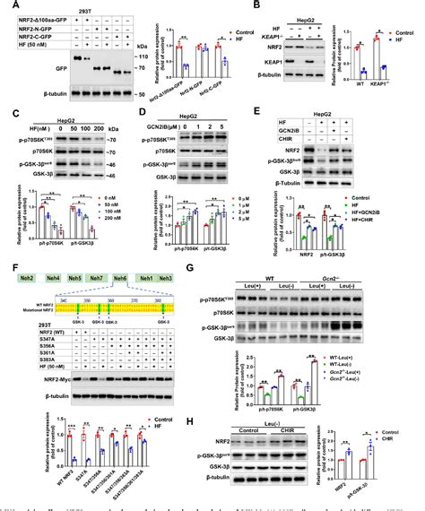 Figure 1 From Inhibition Of GCN2 Alleviates Hepatic Steatosis And