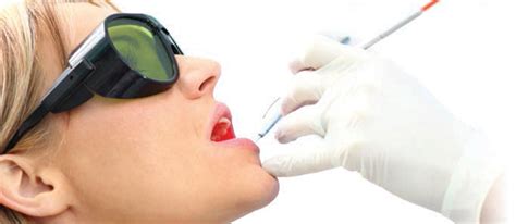 Laser Therapy In Periodontal Treatment